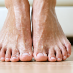Peeling pieds lovaskin : informations et conseils pour mieux comprendre le sujet