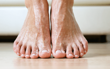 Peeling pieds lovaskin : informations et conseils pour mieux comprendre le sujet